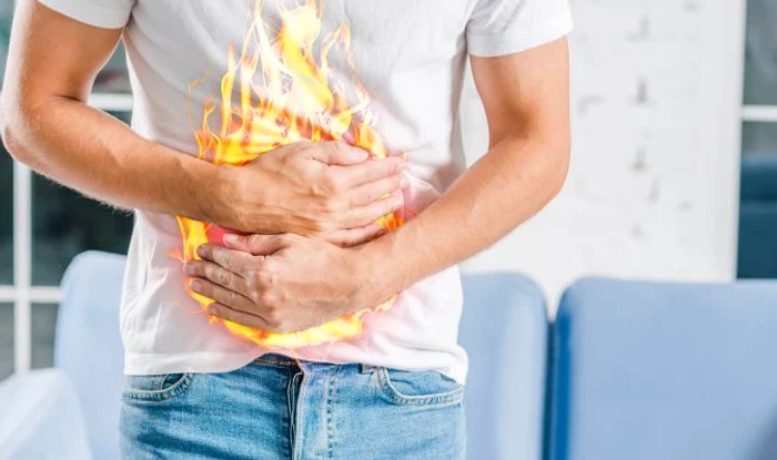 Burns on the stomach photo: archive, truth