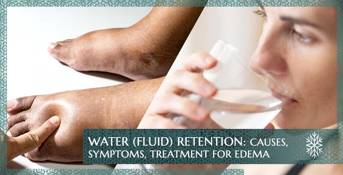 Collage photos with swollen feet and a woman drinking water source blog Svalbardi