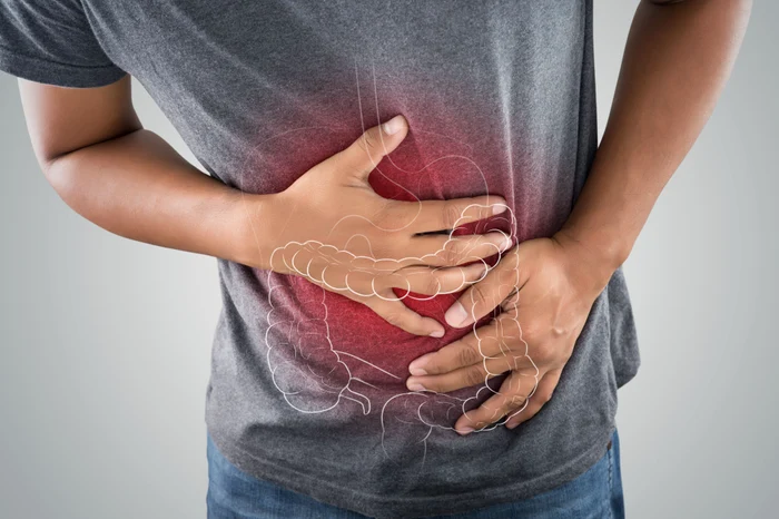 Colorectal cancer remains one of the most common forms of cancer. PHOTO: Shutterstock