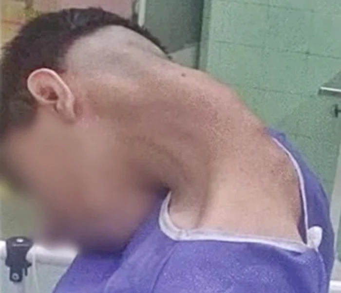 Fall head syndrome: video capture