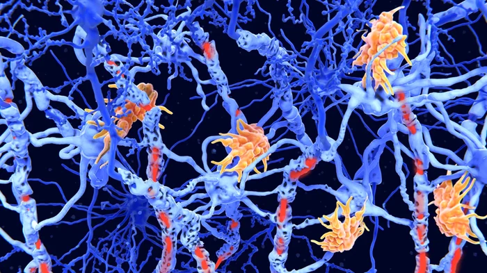 How are nerve cells damaged in the case of autoimmune photo mit technology Review
