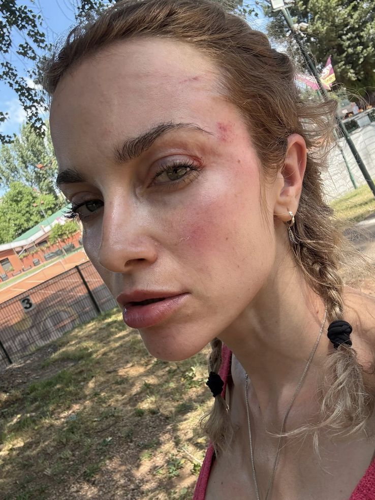 A woman was beaten in Cluj by a supporter of the university. Photo: Facebook @siuko siu