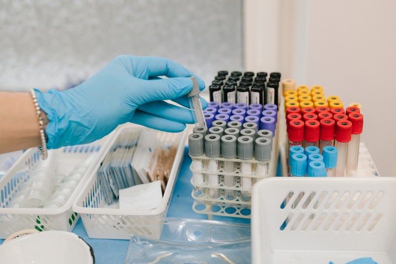Blood / photo analyzes: Anatolii Rabizo | Dreamstime.com