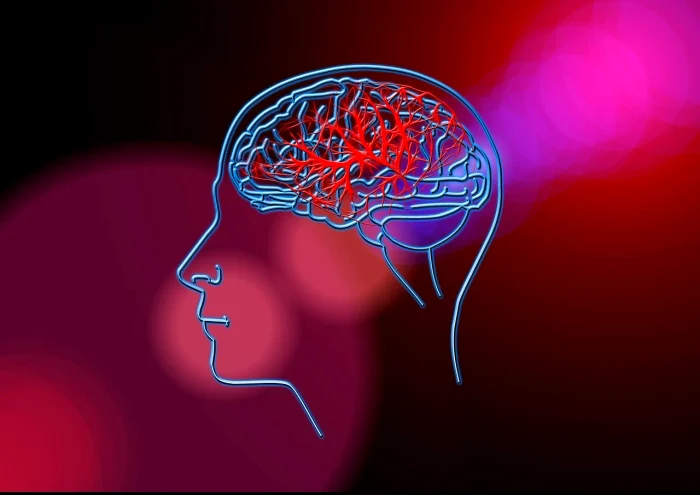 How to reduce the risk of stroke. Photo: Pixabay