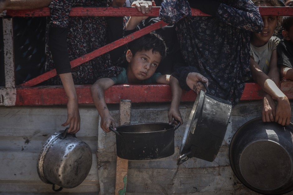 Palestinian children starve in the Gaza Strip, July 22, 2025.