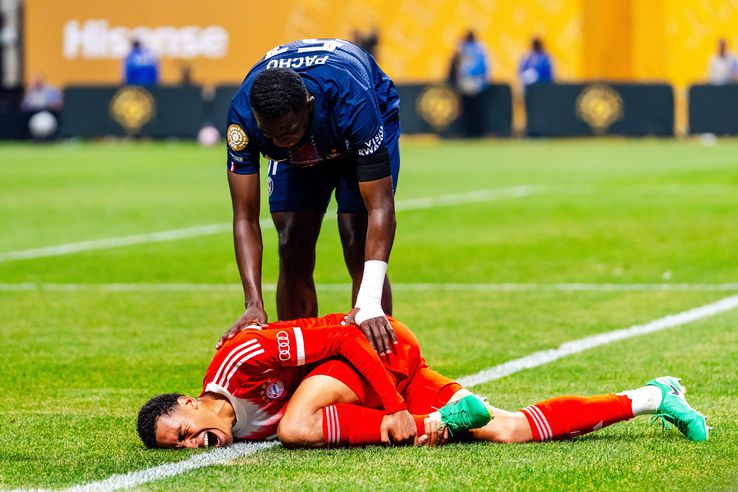 His musiala injury (1)
