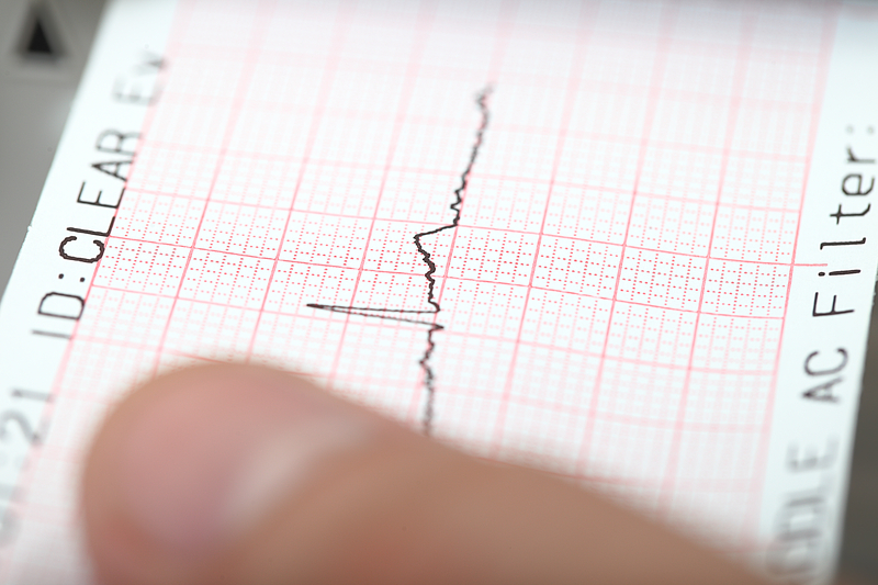 A new major earthquake in the Russian Kamceatka peninsula, less than two weeks after 8.8