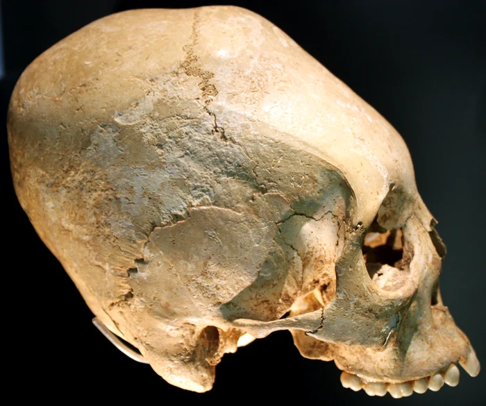 Artificially elongated skull belonging to the tribes of the Germans PHOTO wikipedia