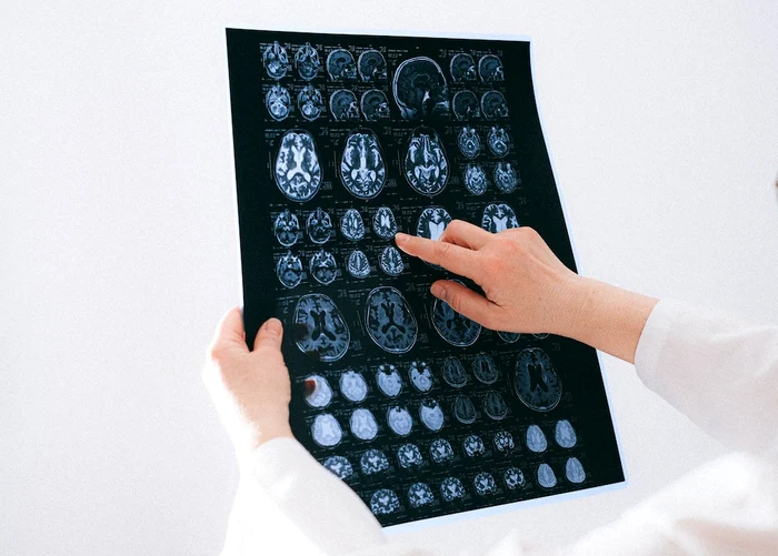 The brain is constantly reorganizing its neural connections. PHOTO: Pexels