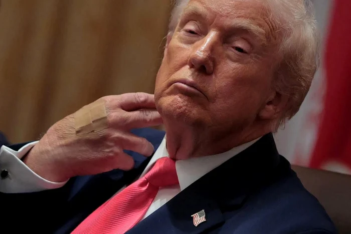 Donald Trump wears a bandage on his hand PHOTO: X
