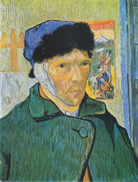 Vincent van Gogh with a bandaged ear/PHOTO: Wikipedia