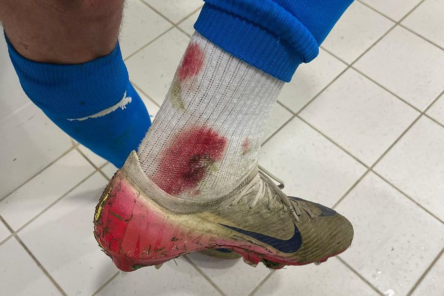 Picture of Assad Al Hamlawi's foot The Oltenians accuse: