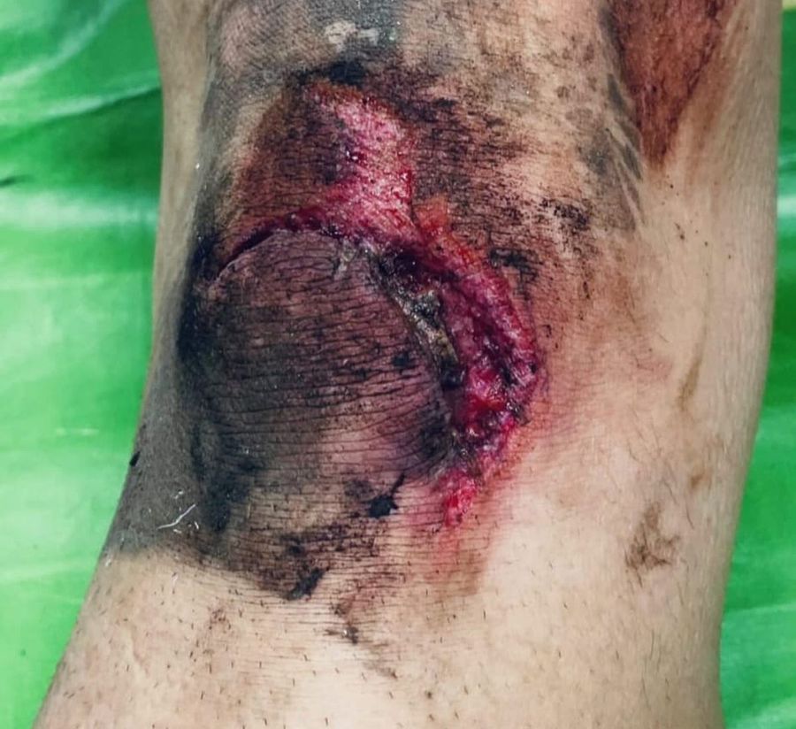 Nightmare injury in League 2 from Romania! The football player raised by Hagi sprained his knee: 