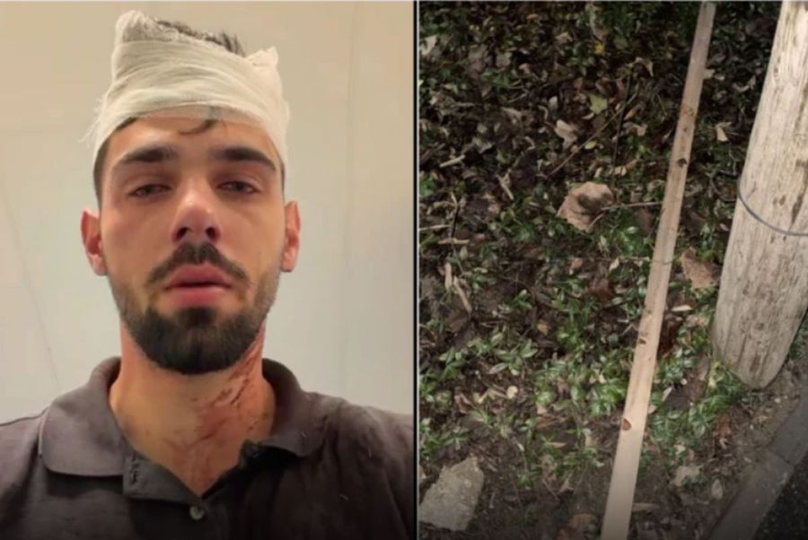 Shocking scandal! Two football players from Poli Timișoara, accused of beating a 19-year-old young man: 