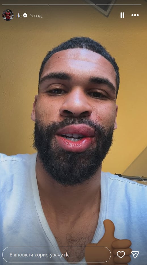 Broken jaw, knocked out teeth and split lips. Star 