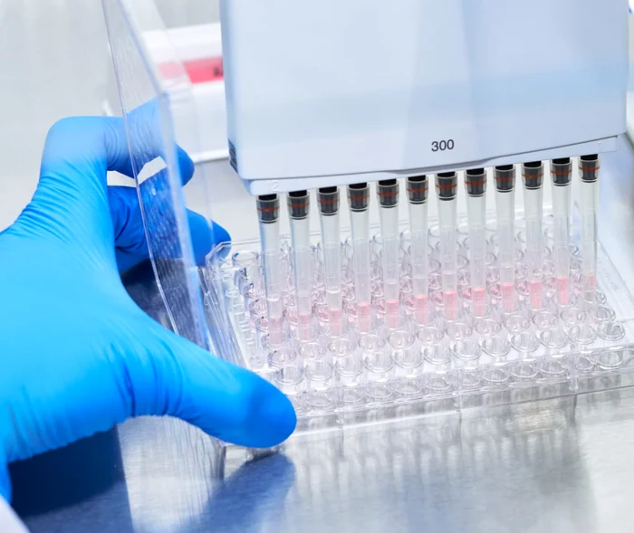 Blood test PHOTO: Shutterstock