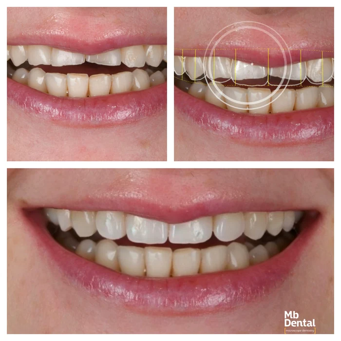 MB Dental case collage jpg
