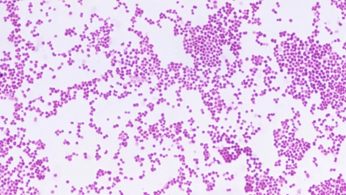 PHOTO: CNRI/Science Photo Library