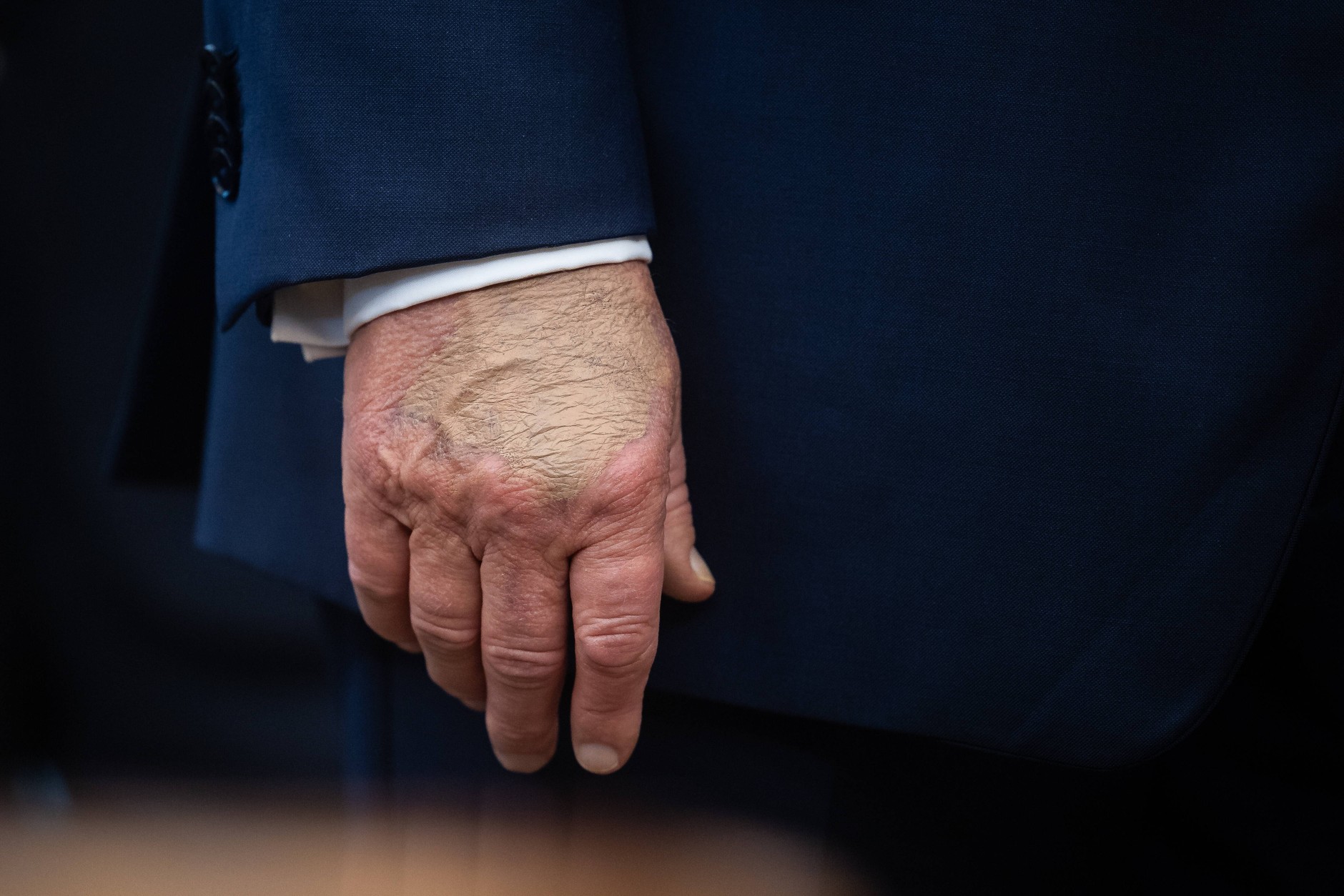 Donald Trump's hand