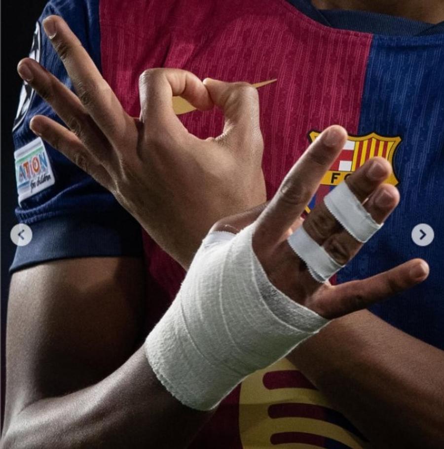 Lamine Yamal unraveled the mystery of the bandage: 
