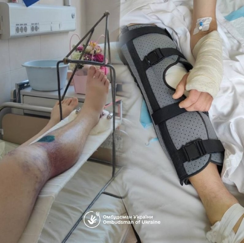 Ombudsman Calls for Dismantling 'Busification' Practice Following Police Incident — The Ombudsman, Lubinets, demands acc