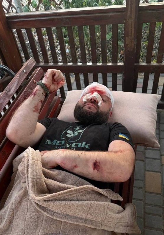 Military Man Assaulted with Rebar Over Comment About Russian Music — A soldier was brutally attacked in Zatoka after cri