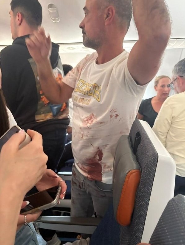 Pilot Attack Incident Involves Omani and Emirati Nationals — Details emerge about a recent pilot attack, revealing the a