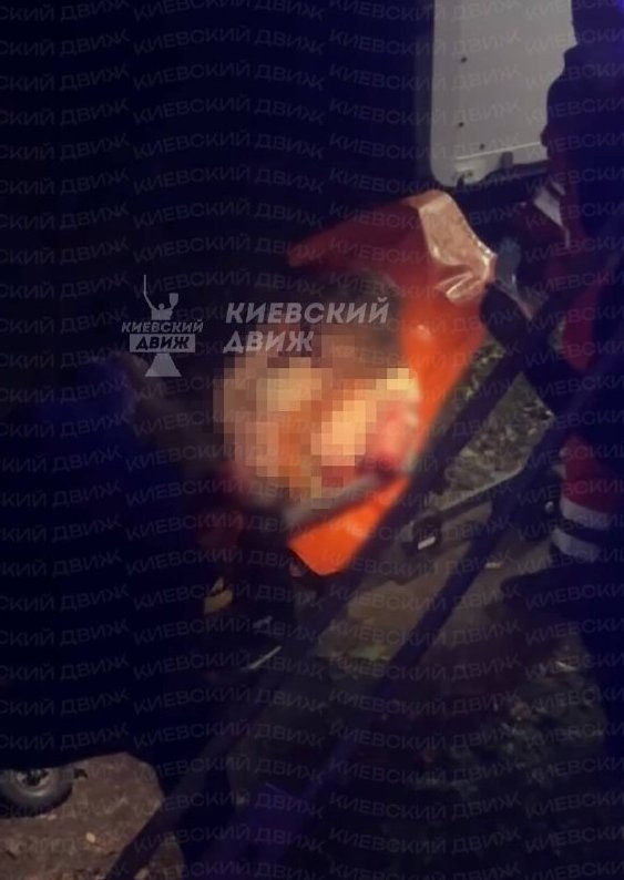Train Accident in Ukraine Results in Amputation of Woman's Arm — A train traveling from Kyiv to Nizhyn amputated a woman