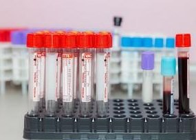 Anti-Doping Agency's New Contract Sparks Controversy Amid Sharp Drop in Testing — The National Anti-Doping Agency faces